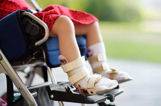 Breakthrough discovery may help children with cerebral palsy walk