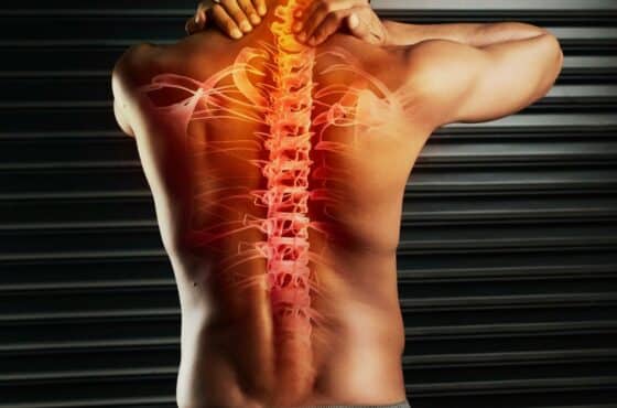 How Much Is a Spinal Cord Injury Lawsuit Worth?